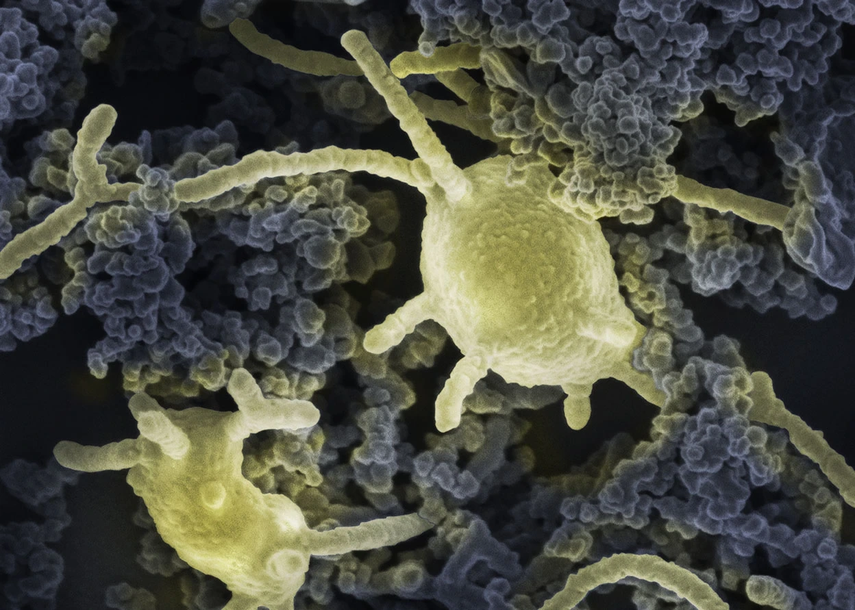 cultured-asgard-archaea-reveal-clues-to-origin-of-complex-life